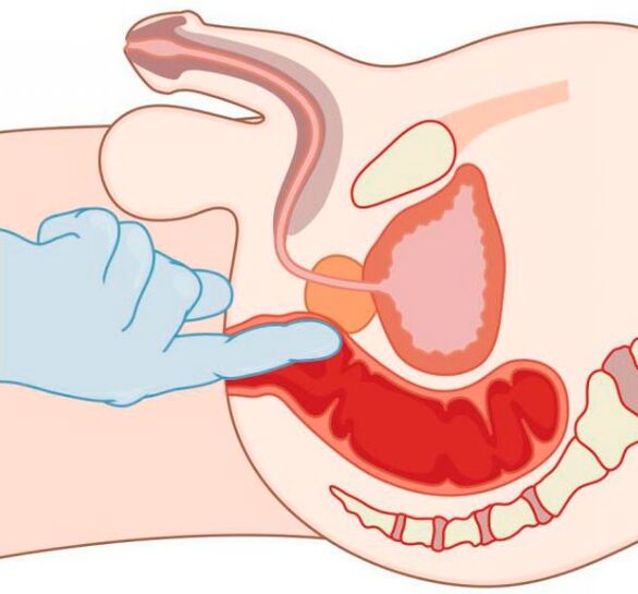 G-spot stimulation in a man through the anus